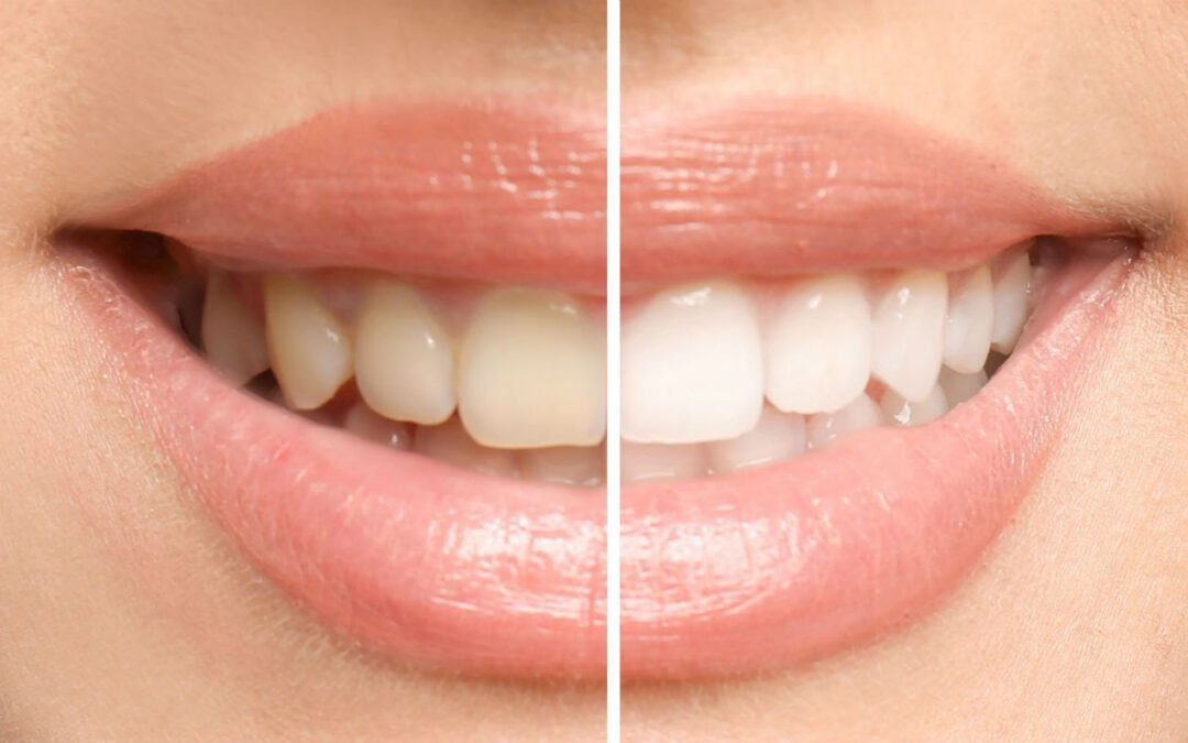 Discover the Art of Transformative Smiles with Dr. Jivan